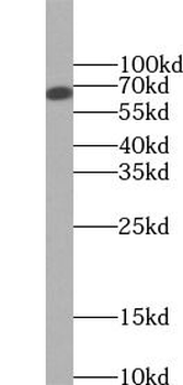 CXCR4 Mouse Monoclonal Antibody