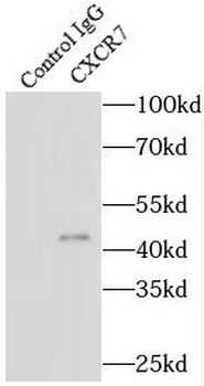 ACKR3 Rabbit Polyclonal Antibody