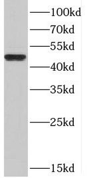 ACKR3 Rabbit Polyclonal Antibody