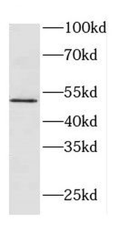ACKR3 Rabbit Polyclonal Antibody