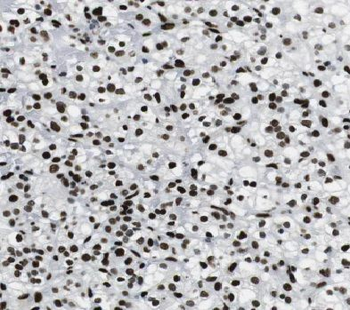 ACKR3 Rabbit Polyclonal Antibody