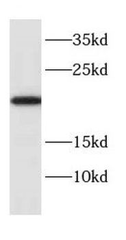 CYB5B Rabbit Polyclonal Antibody