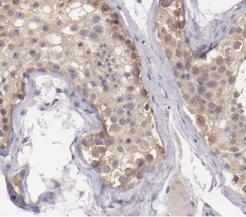 CYB5B Rabbit Polyclonal Antibody
