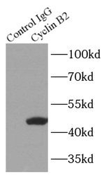 CCNB2 Rabbit Polyclonal Antibody