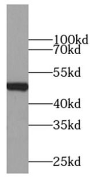 CCNB2 Rabbit Polyclonal Antibody