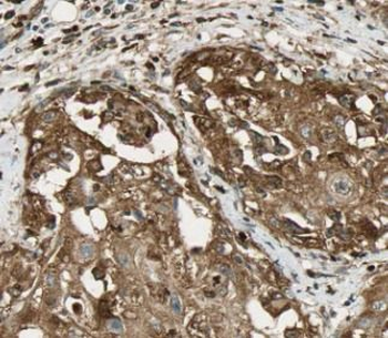 CCNB2 Rabbit Polyclonal Antibody