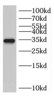 CCND3 Rabbit Polyclonal Antibody