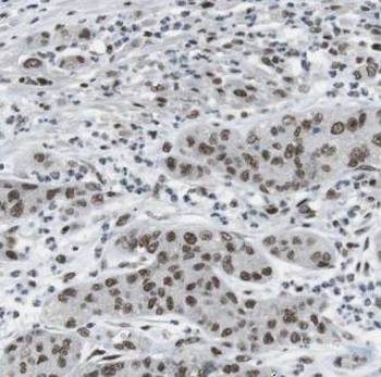 CCND3 Rabbit Polyclonal Antibody