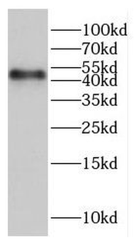 UBE2D1 Rabbit Polyclonal Antibody