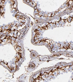 UBE2D1 Rabbit Polyclonal Antibody