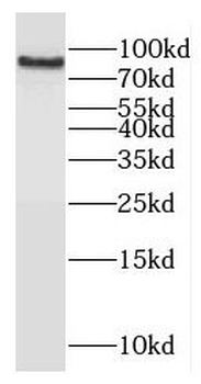 CCNT1 Rabbit Polyclonal Antibody