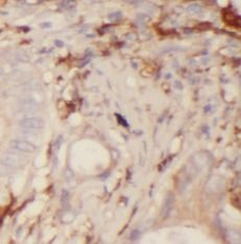 PPIA Rabbit Polyclonal Antibody