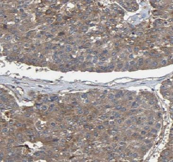 PPIB Mouse Monoclonal Antibody