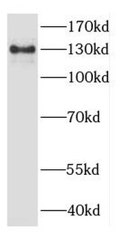 CYFIP2 Rabbit Polyclonal Antibody