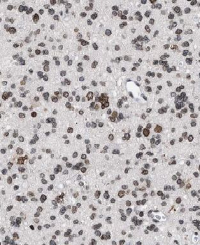 CYFIP2 Rabbit Polyclonal Antibody