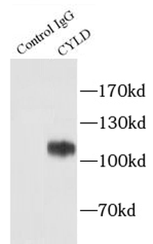 CYLD Rabbit Polyclonal Antibody