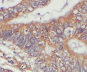 CYLD Rabbit Polyclonal Antibody