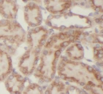 CYP24A1 Rabbit Polyclonal Antibody
