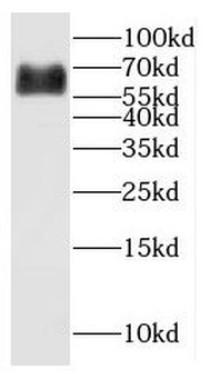 CYP27A1 Rabbit Polyclonal Antibody