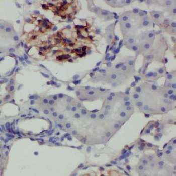CYP27A1 Rabbit Polyclonal Antibody