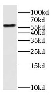 CYP27A1 Rabbit Polyclonal Antibody