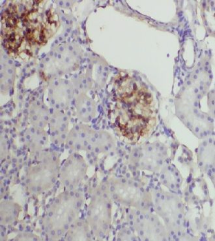 CYP27A1 Rabbit Polyclonal Antibody