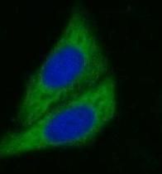 CYP3A4 Rabbit Polyclonal Antibody