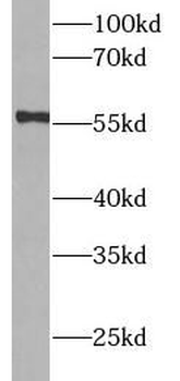 CYP3A4 Rabbit Polyclonal Antibody