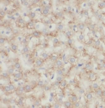 CYP3A4 Rabbit Polyclonal Antibody