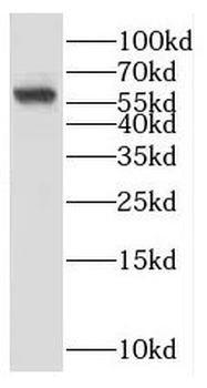 CYP4A11 Rabbit Polyclonal Antibody