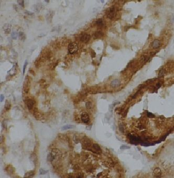 CYP4A11 Rabbit Polyclonal Antibody