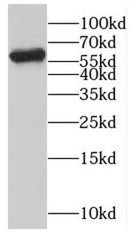 CYP4F3 Rabbit Polyclonal Antibody
