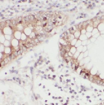 CSTB Rabbit Polyclonal Antibody