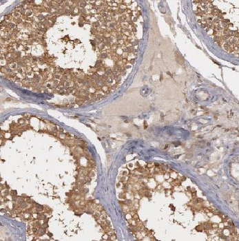 CYTL1 Rabbit Polyclonal Antibody