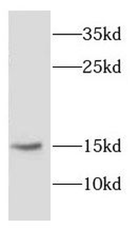 CYB5R3 Rabbit Polyclonal Antibody