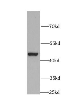KRT19 Rabbit Polyclonal Antibody