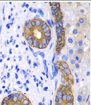 KRT19 Rabbit Polyclonal Antibody