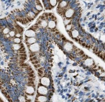 KRT19 Rabbit Polyclonal Antibody