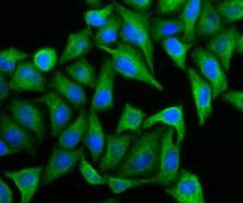 KRT20 Rabbit Polyclonal Antibody