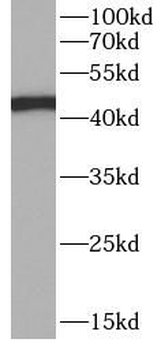 KRT20 Rabbit Polyclonal Antibody