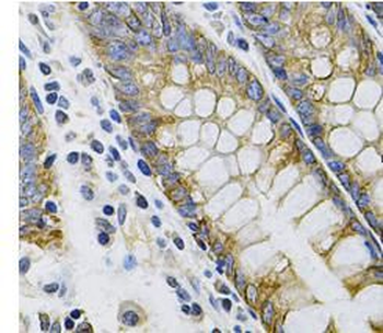 KRT20 Rabbit Polyclonal Antibody