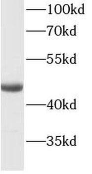 KRT20 Mouse Monoclonal Antibody