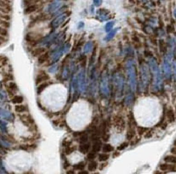 KRT20 Mouse Monoclonal Antibody