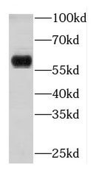 KRT4 Rabbit Polyclonal Antibody