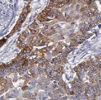 KRT4 Rabbit Polyclonal Antibody