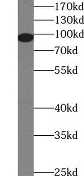DAB2 Rabbit Polyclonal Antibody