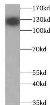 DAB2IP Rabbit Polyclonal Antibody