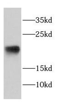 DAND5 Rabbit Polyclonal Antibody