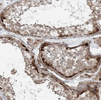 DAND5 Rabbit Polyclonal Antibody