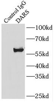 DARS1 Rabbit Polyclonal Antibody